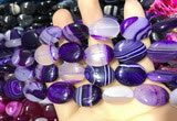 CAA2172 15.5 inches 15*20mm oval banded agate beads wholesale