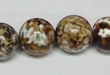 CAB614 15.5 inches 18mm round leopard skin agate beads wholesale