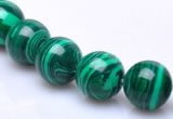 CMA20 15.5 inches 10mm round imitate malachite beads Wholesale