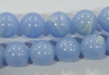 CTU1737 15.5 inches 16mm round synthetic turquoise beads